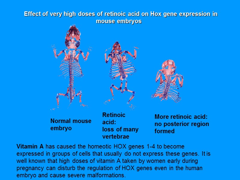 Normal mouse embryo Retinoic acid: loss of many vertebrae More Normal mouse embryo Retinoic acid: loss of many vertebrae More